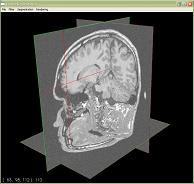 GPU-based Volume Segmentation