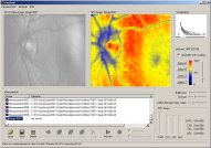 Screenshot of EyeScan